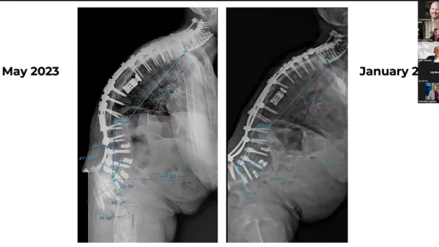 spinal imaging